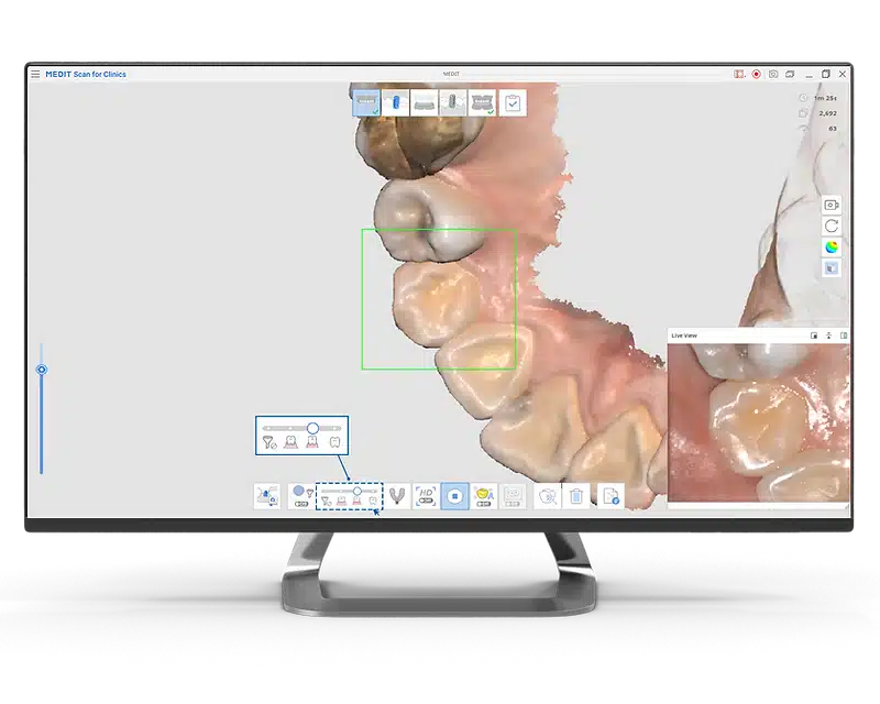 Sb Tandartsen Digitale Mondscanner Afdrukgebit